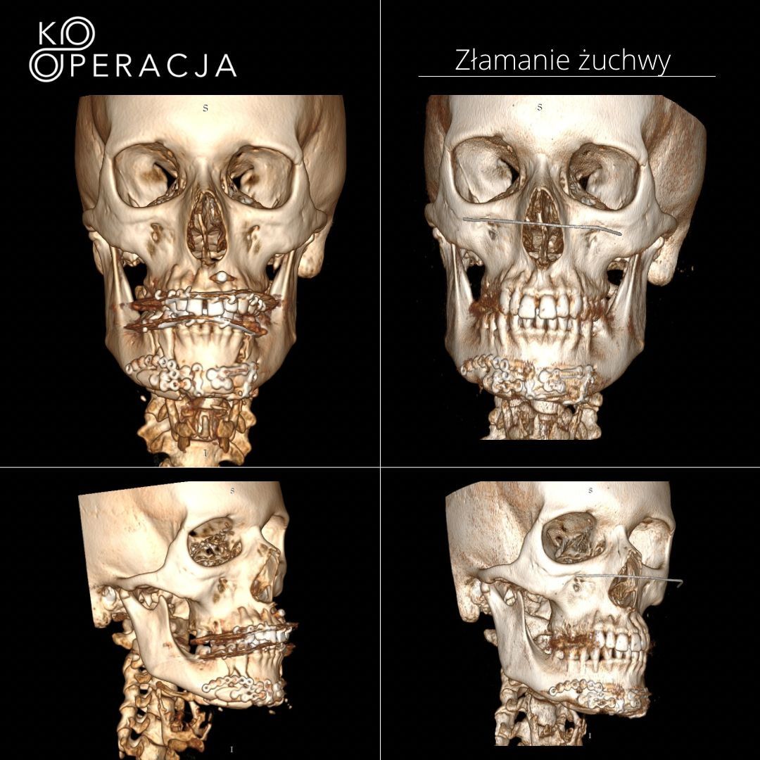Paweł Poniatowski-22