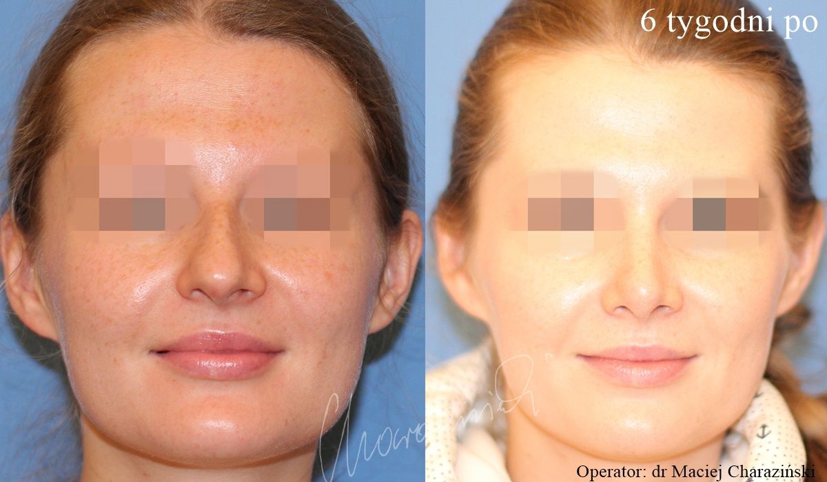 Maciej Charaziński-61