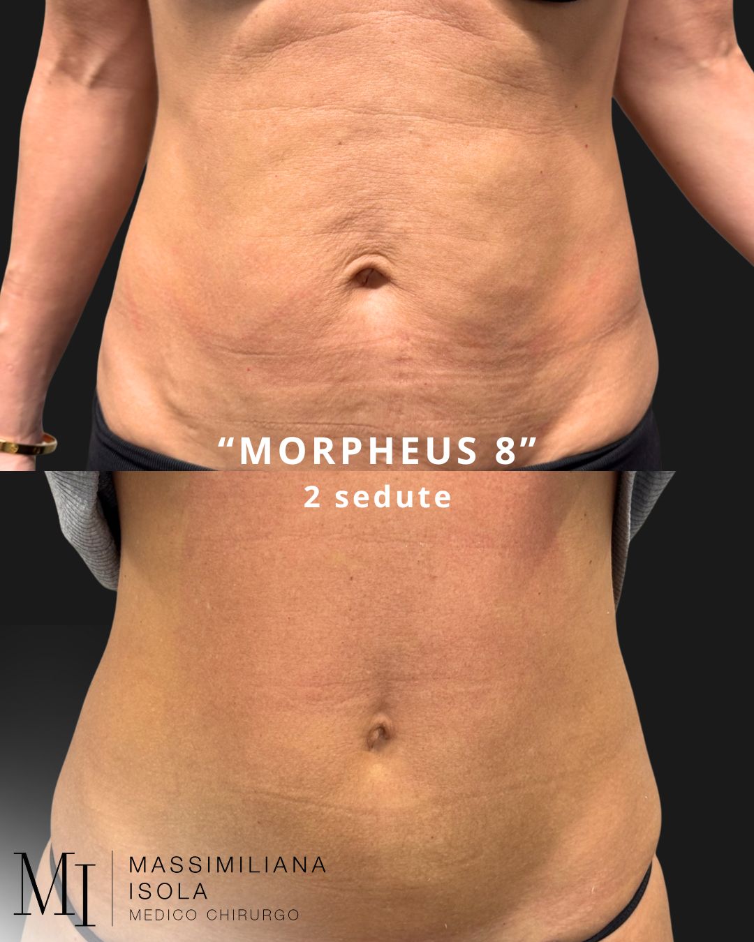 Massimiliana Isola-1