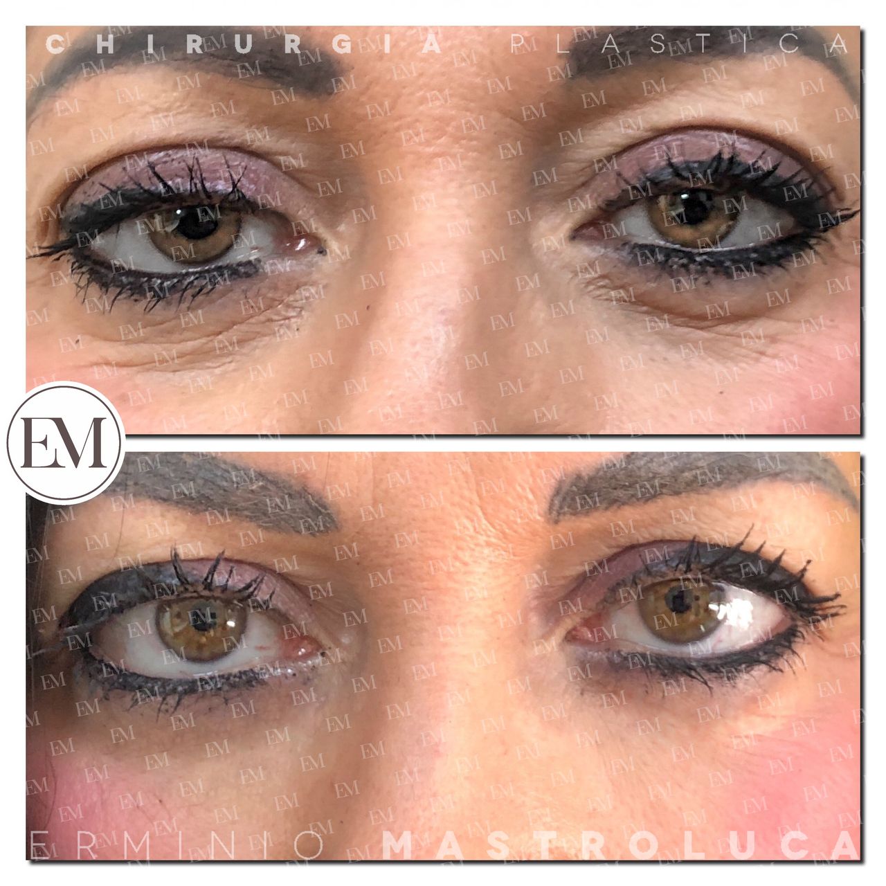 Erminio Mastroluca-7