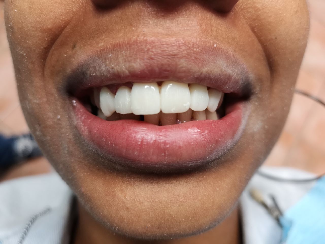 Stefano De Simone-38