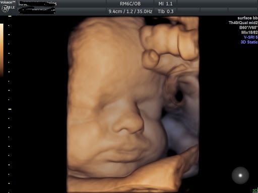 D'ambrosi Francesco-5