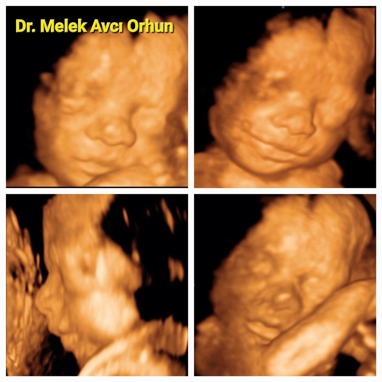 Şahver Melek Avcı Orhun-9