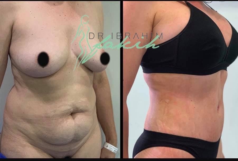 Ibrahim Fakih Gómez-9