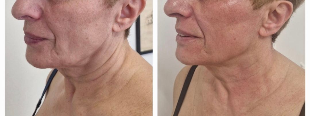 Guglielmina Chinaglia-7