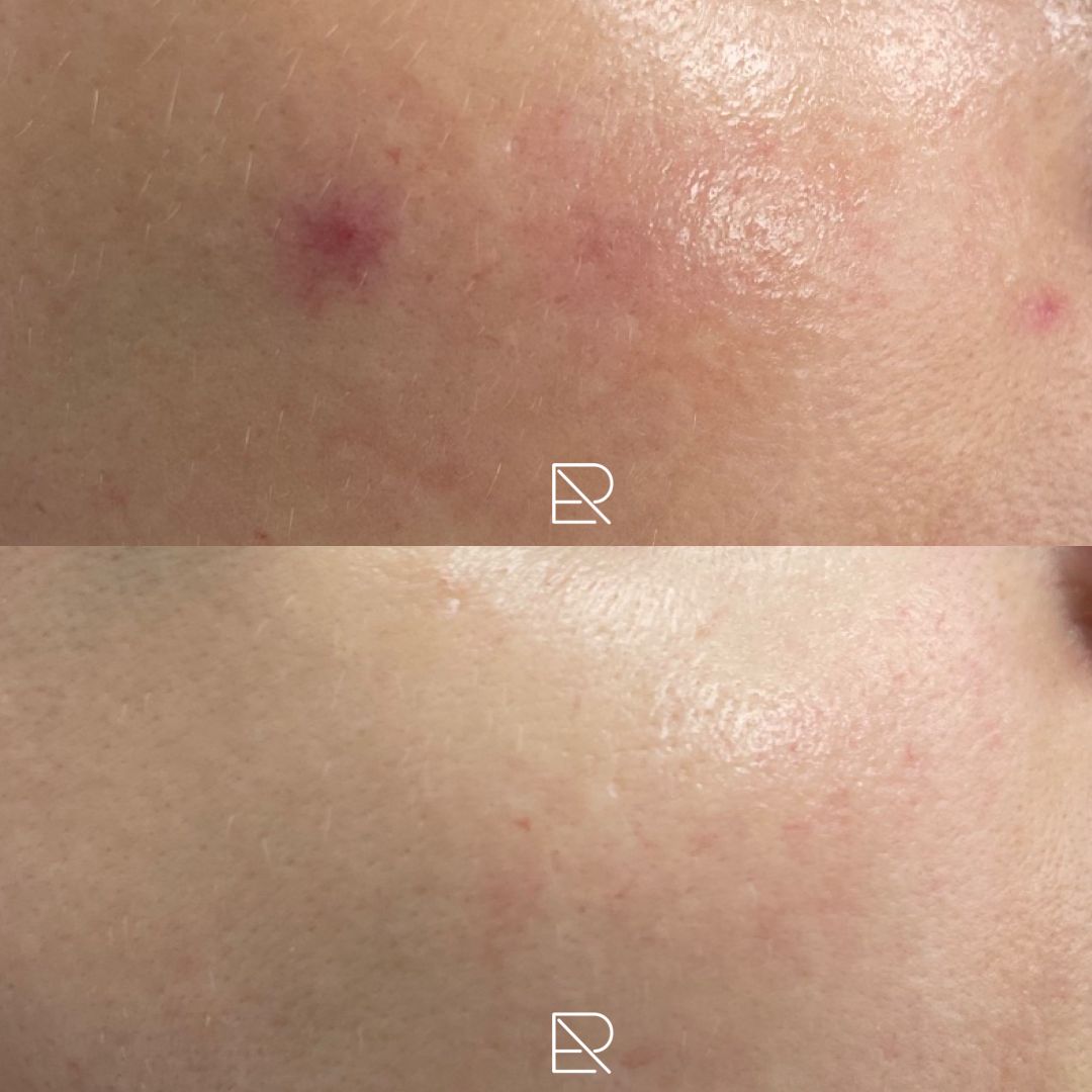 Federica Di Ruscio-23