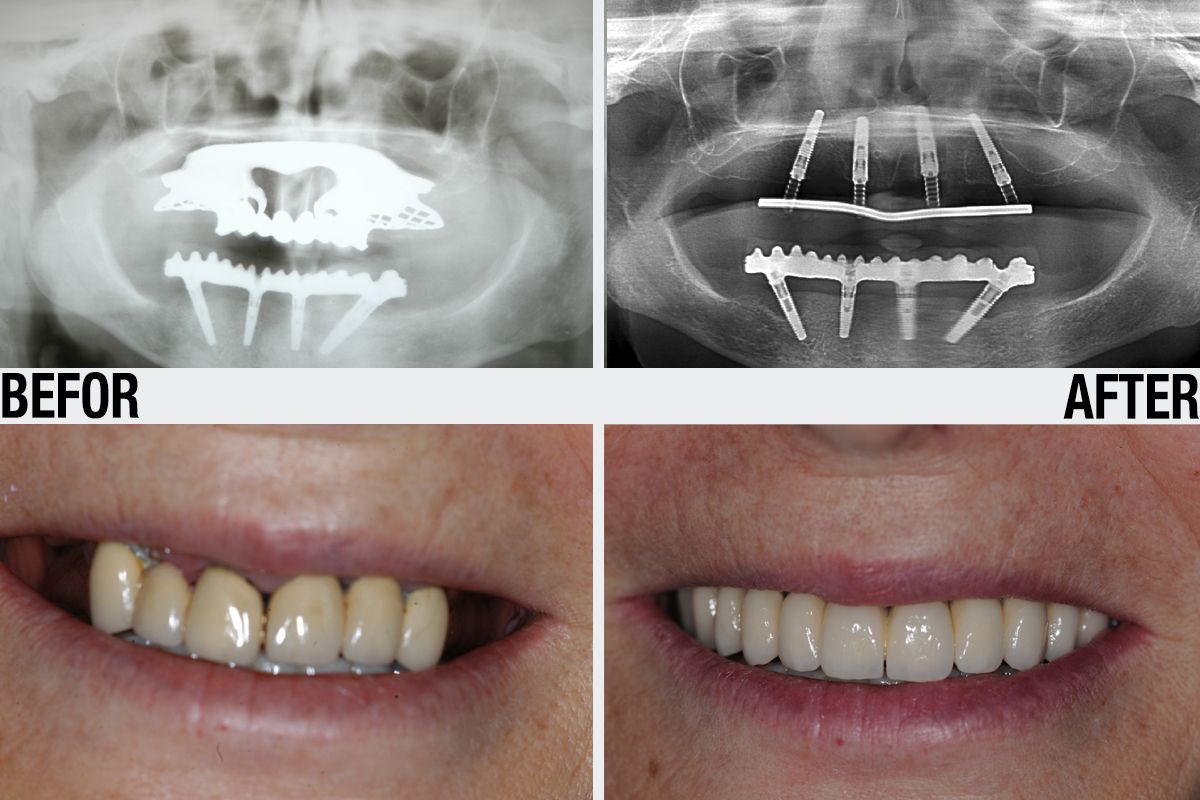 Alessandro Palumbo-41