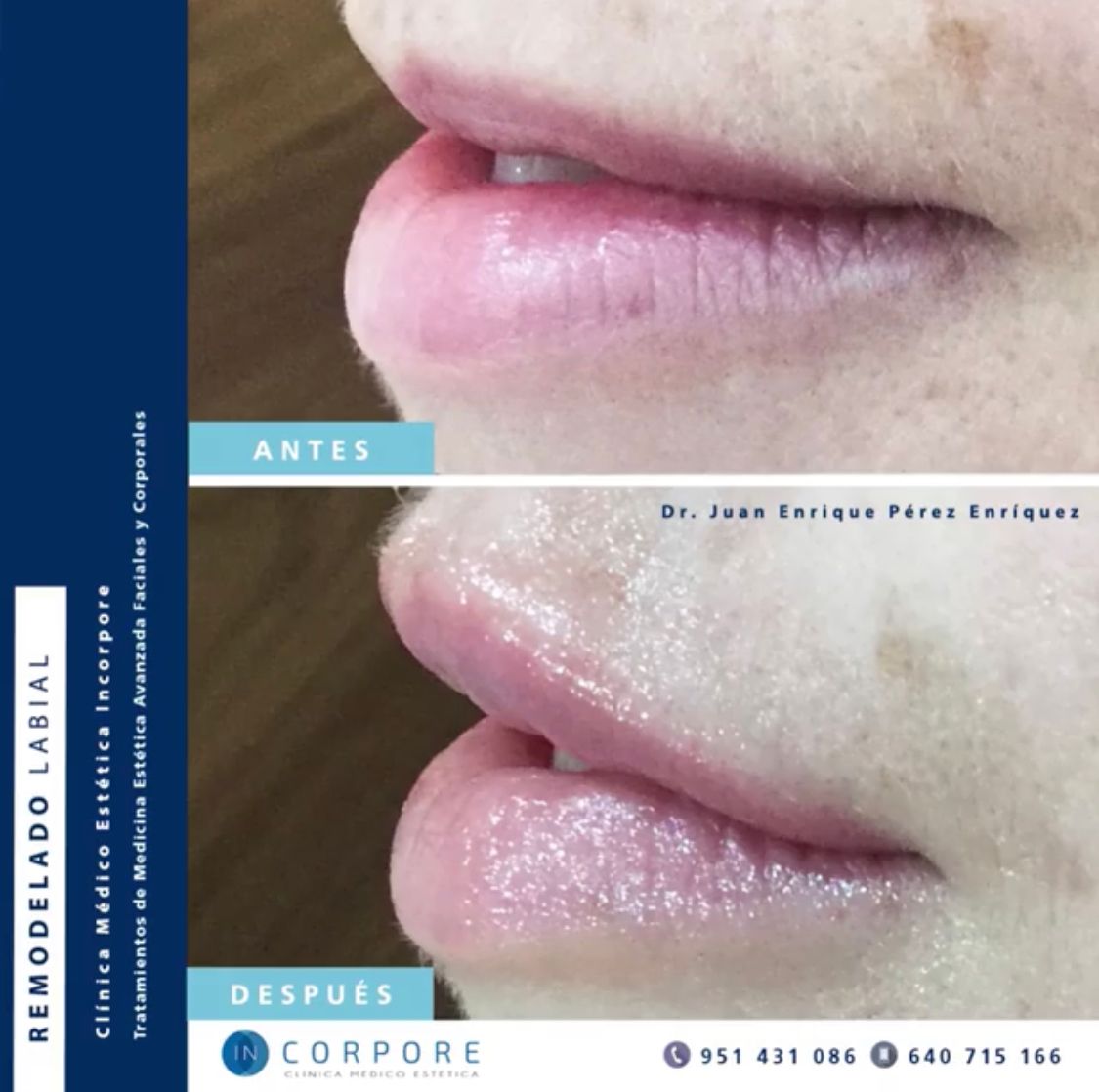 Juan Enrique Pérez Enríquez-49