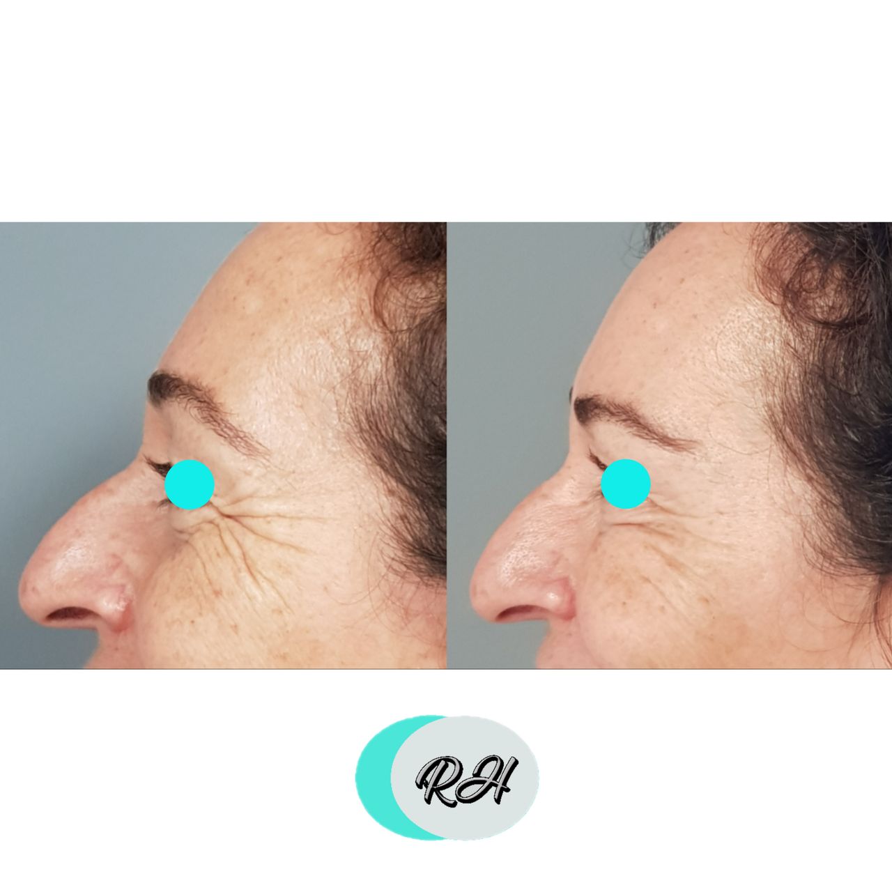 Rosalba Herrero Zerpa-145