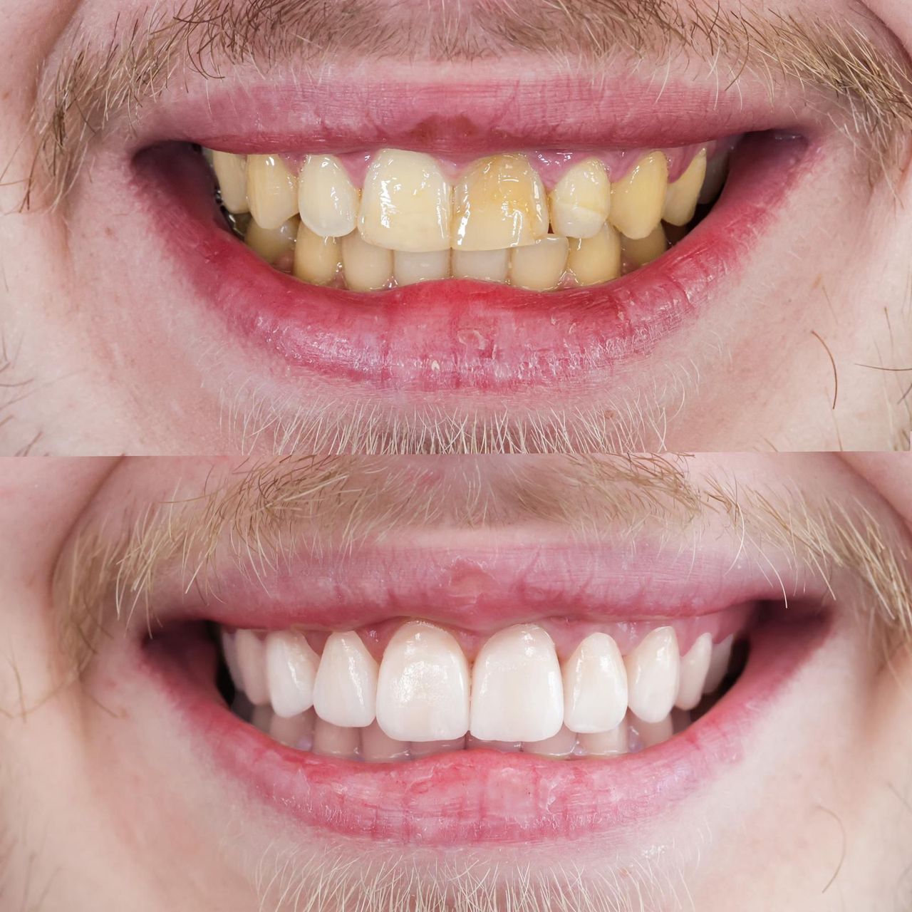 Giampiero Piccione-4