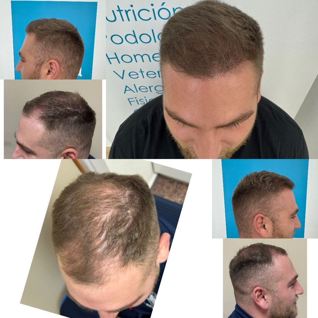 Alberto Mira Olivares-0