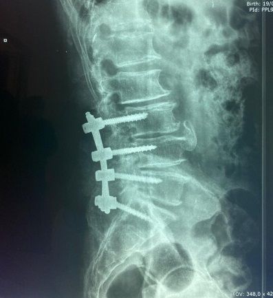 Valerio Cipolloni-19