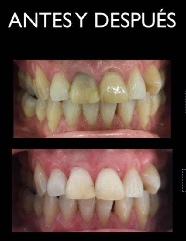 Laura Jareño Massagués-6