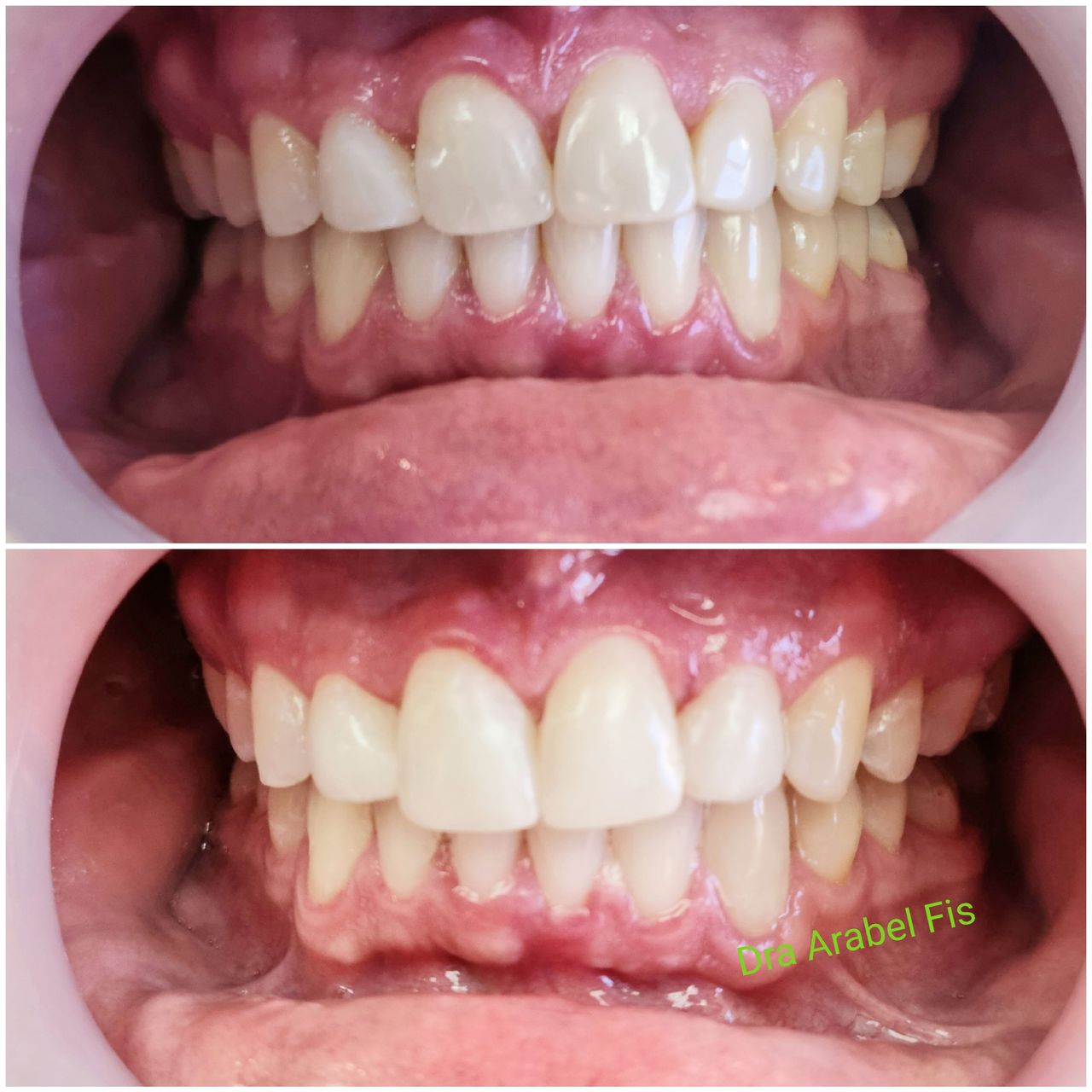 Arabel Fis Rodríguez-8