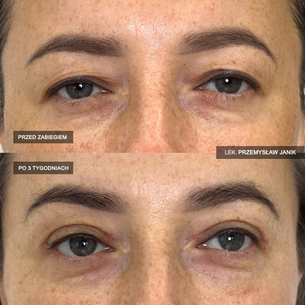 Przemysław Janik-22