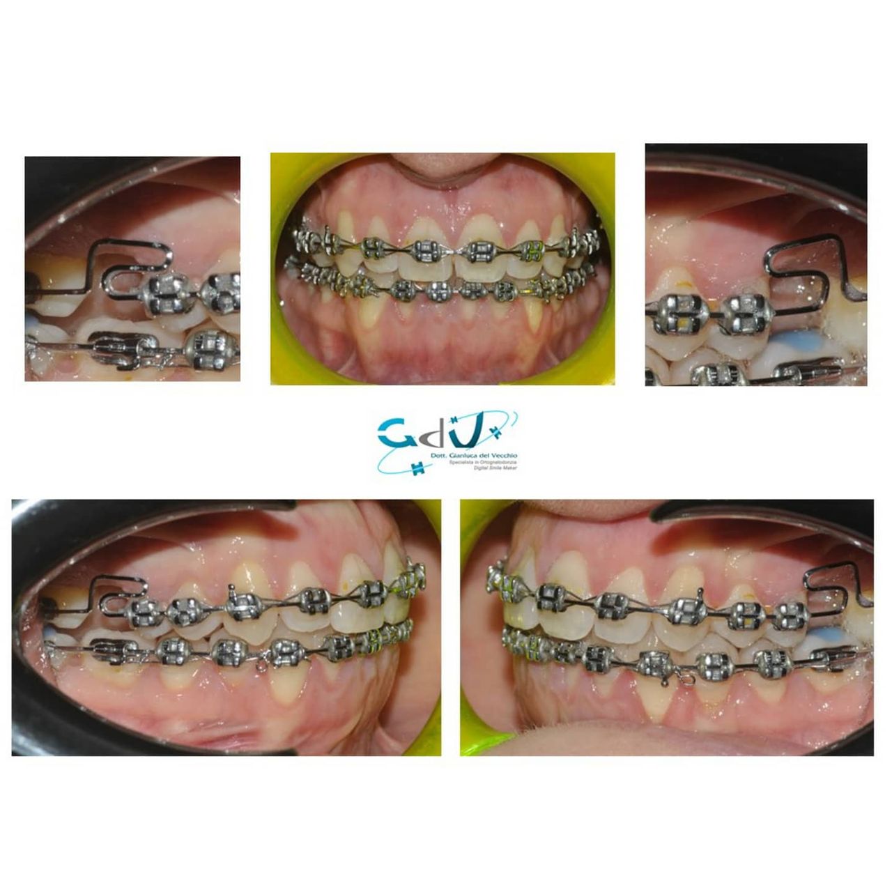 Gianluca Del Vecchio-109