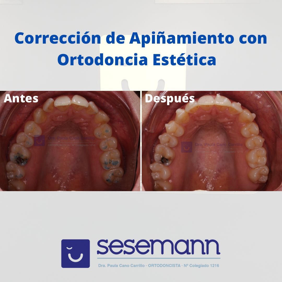 Paula Cano Carrillo-24