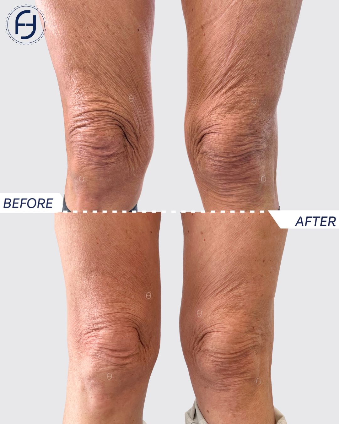 Francesca Flagiello-2