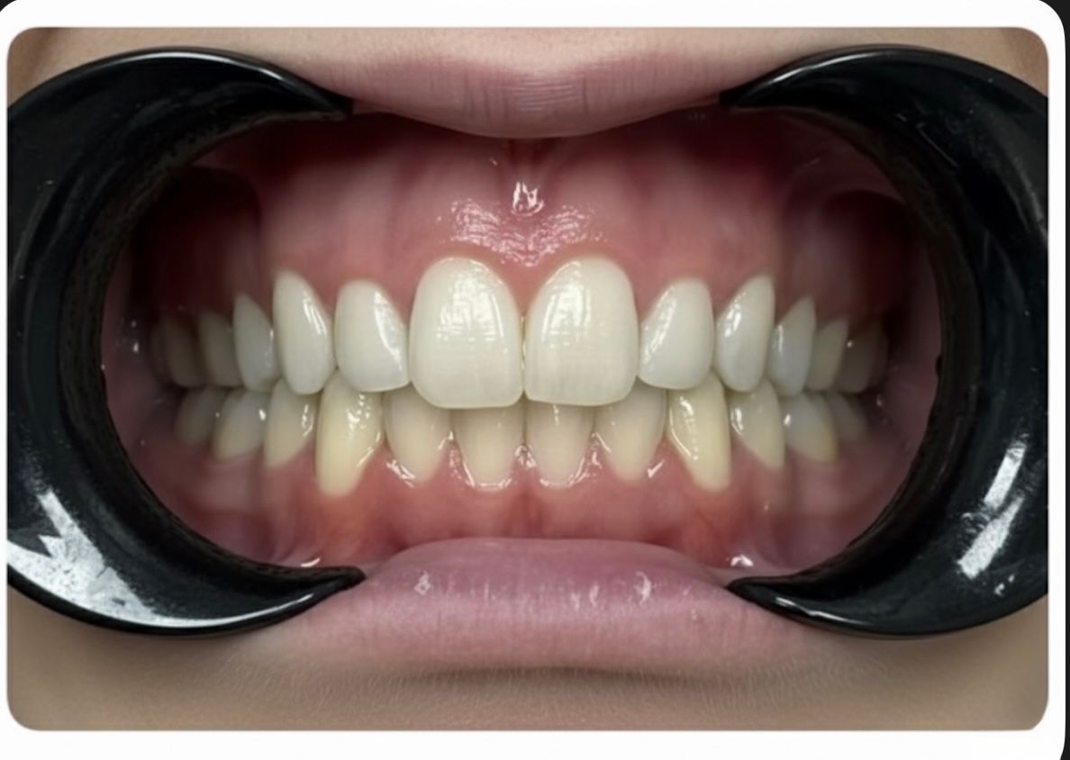 Francesco Sorrentino-9