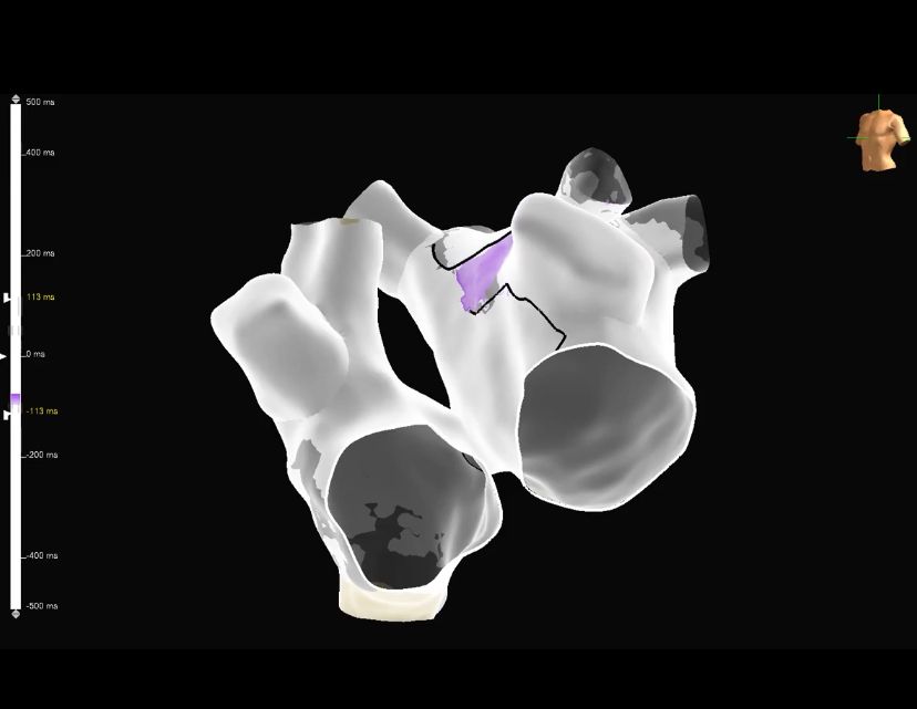 Rodolfo San Antonio Dharandas-2