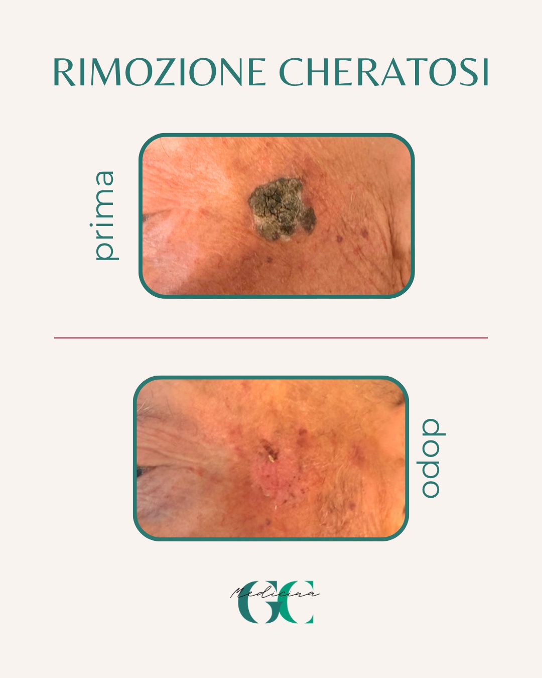 Giacomo Casale-31