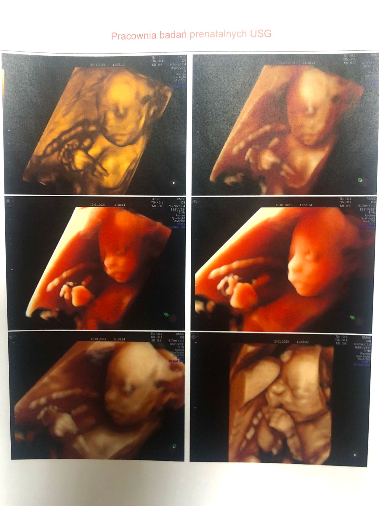 Wioletta Rozmus-Warcholińska-24