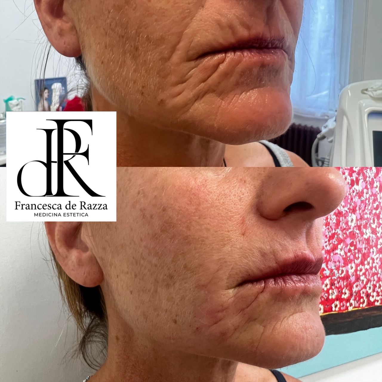 Francesca De Razza-60