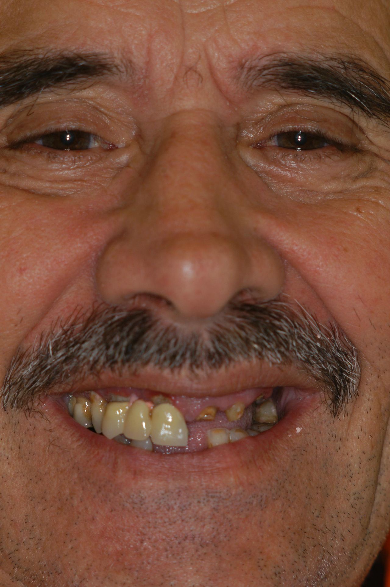 Alessandro Palumbo-22