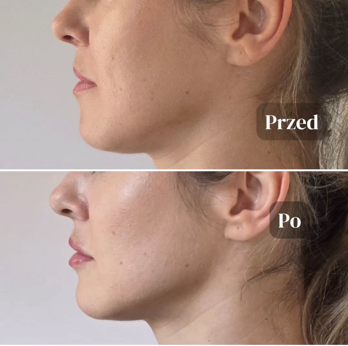 Aleksandra Kowalczuk-11