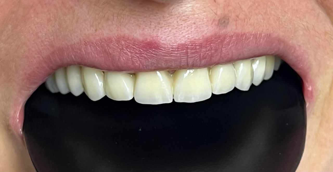 Francesco Giuseppe La Barbera-2