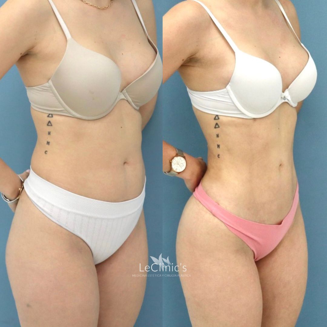 Irasema Regla Bezares Ramos-3