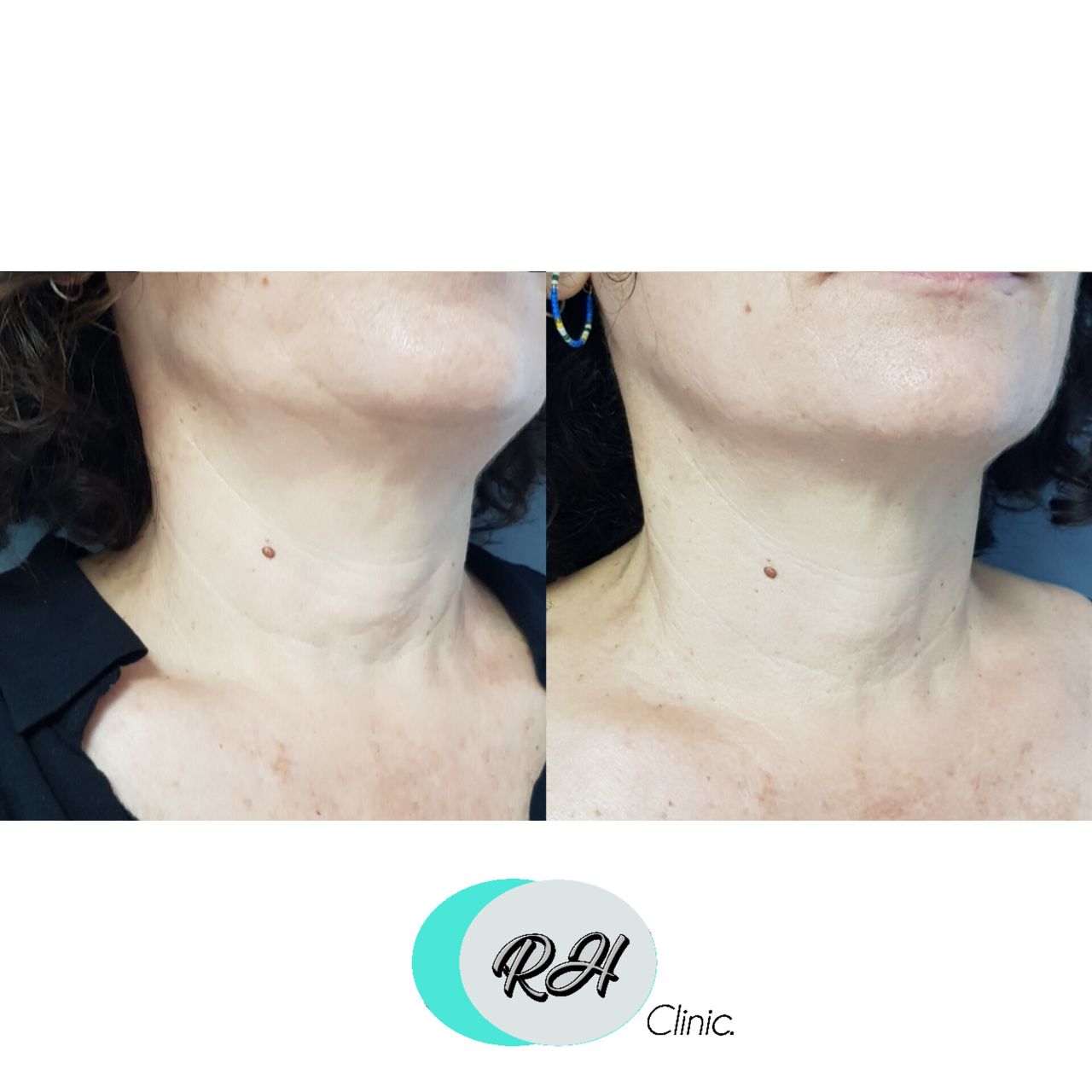 Rosalba Herrero Zerpa-77