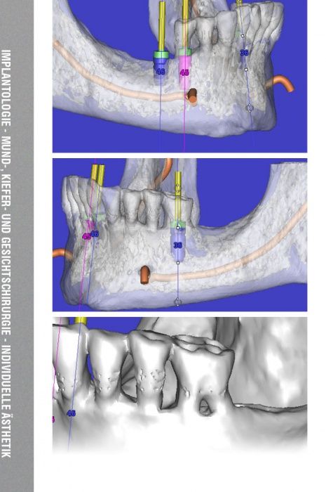Helmut Hildebrandt-3