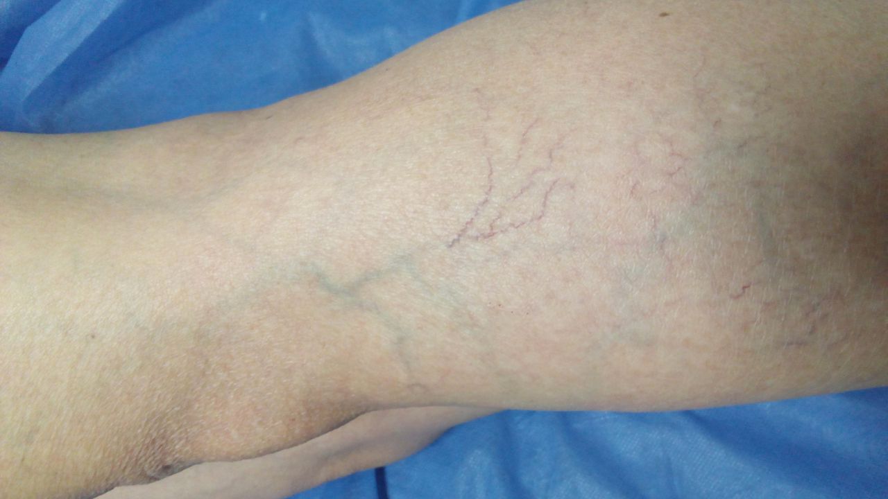 Arnaldo Strazzaboschi-4