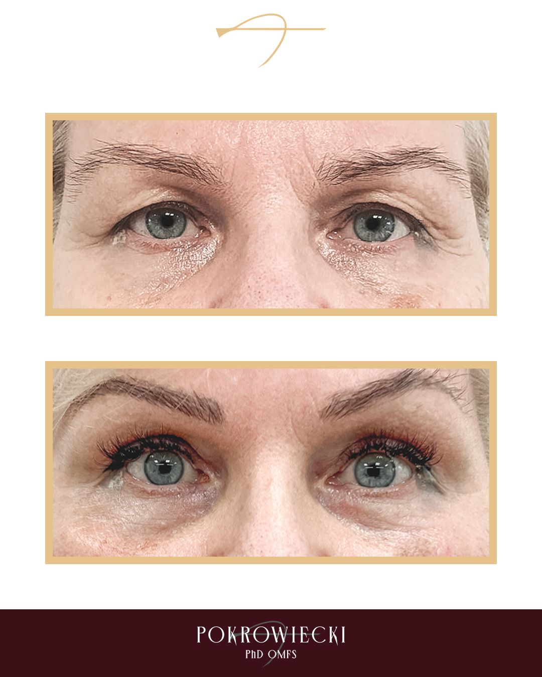 Rafał Pokrowiecki-25