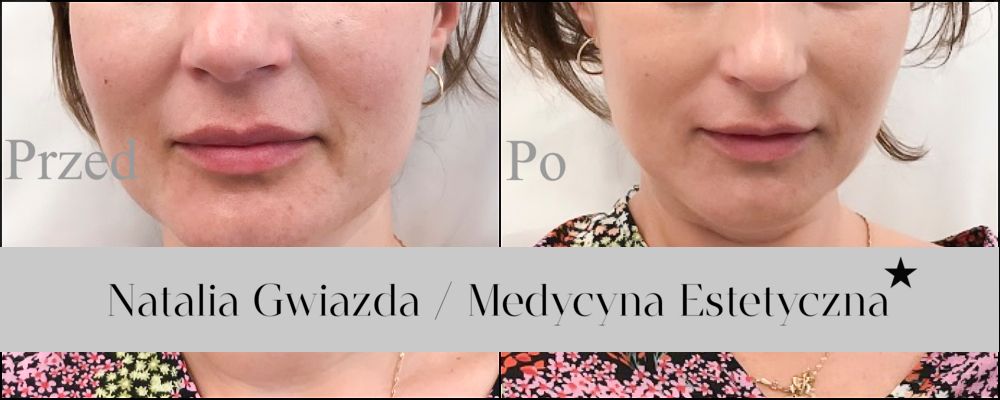 Natalia Gwiazda-2