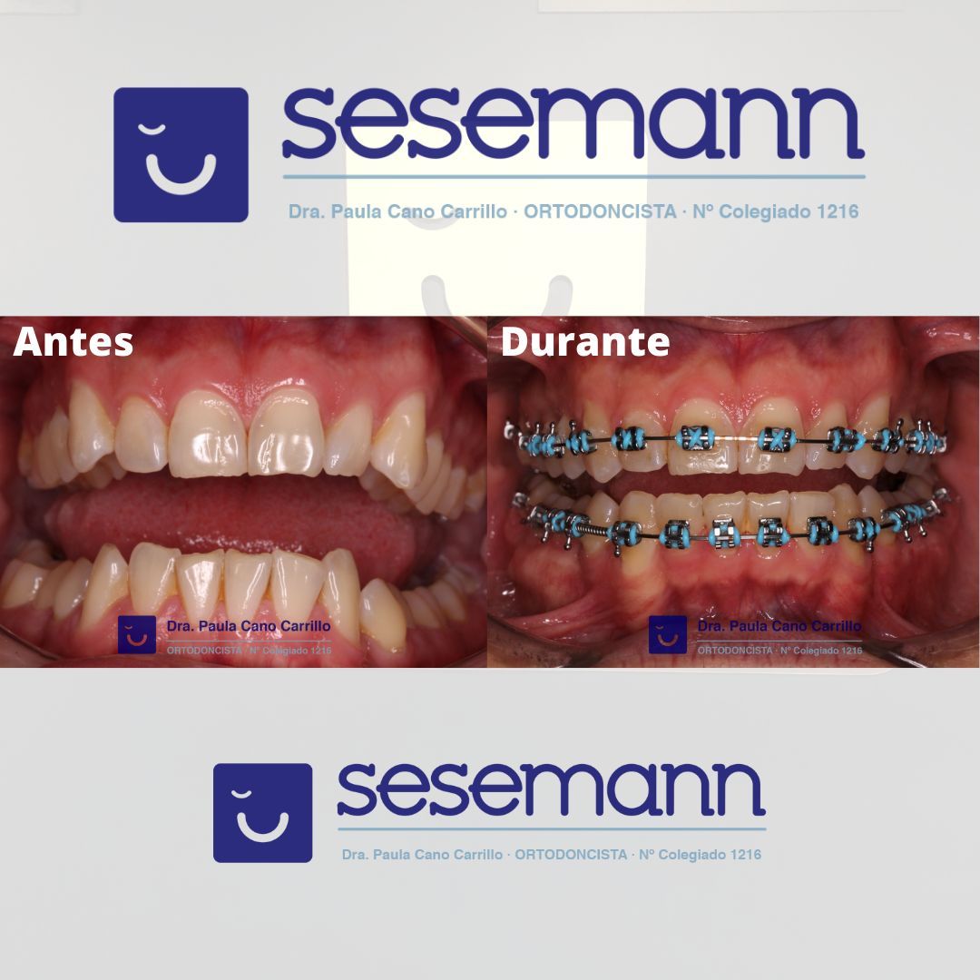 Paula Cano Carrillo-103