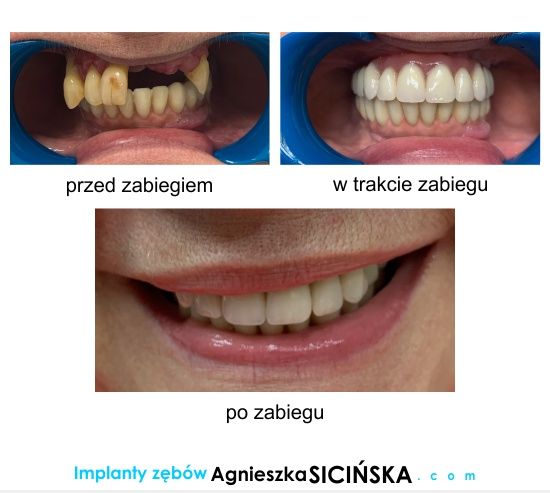 Agnieszka Ewa Sicińska-21