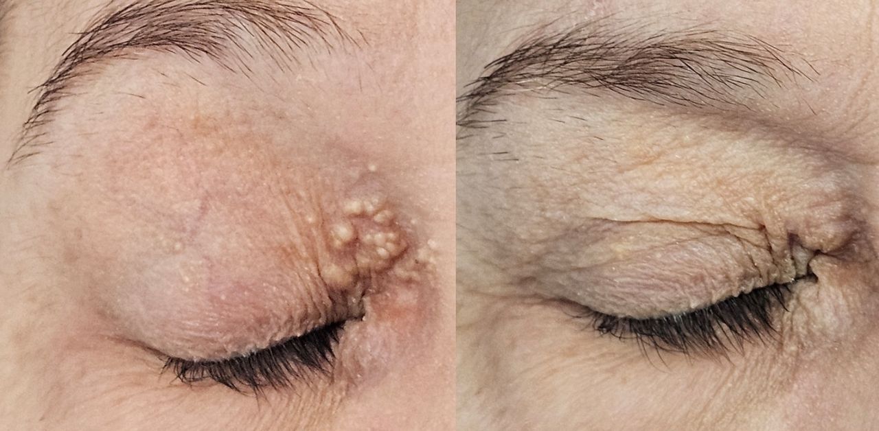 Rosalba Herrero Zerpa-42