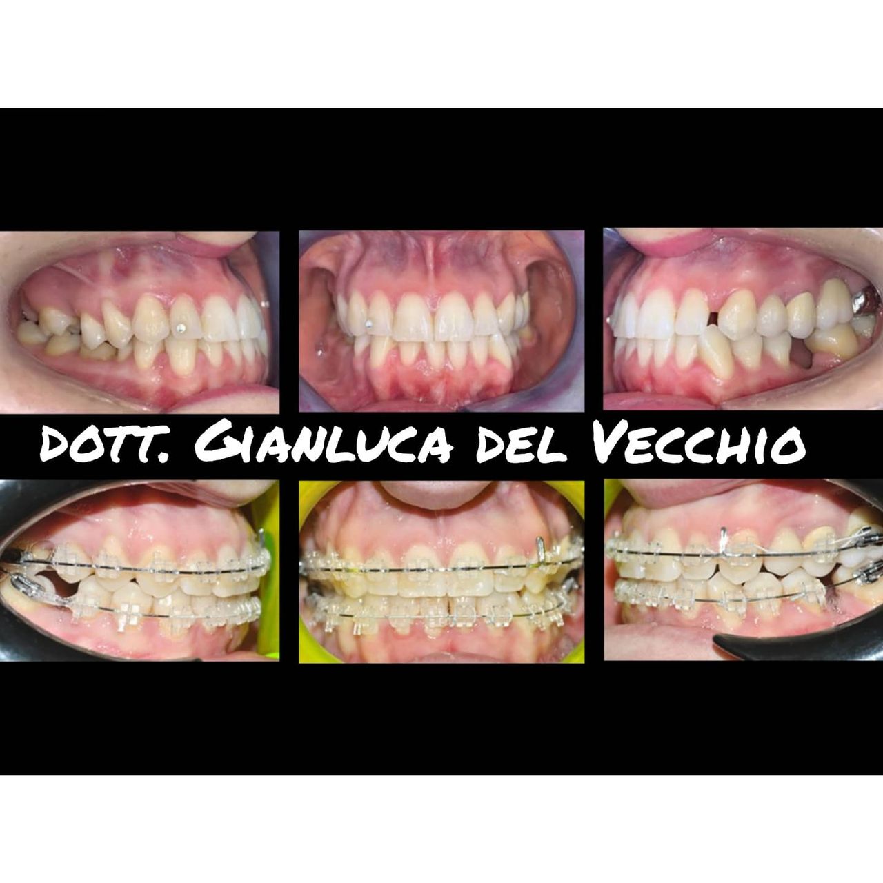 Gianluca Del Vecchio-76