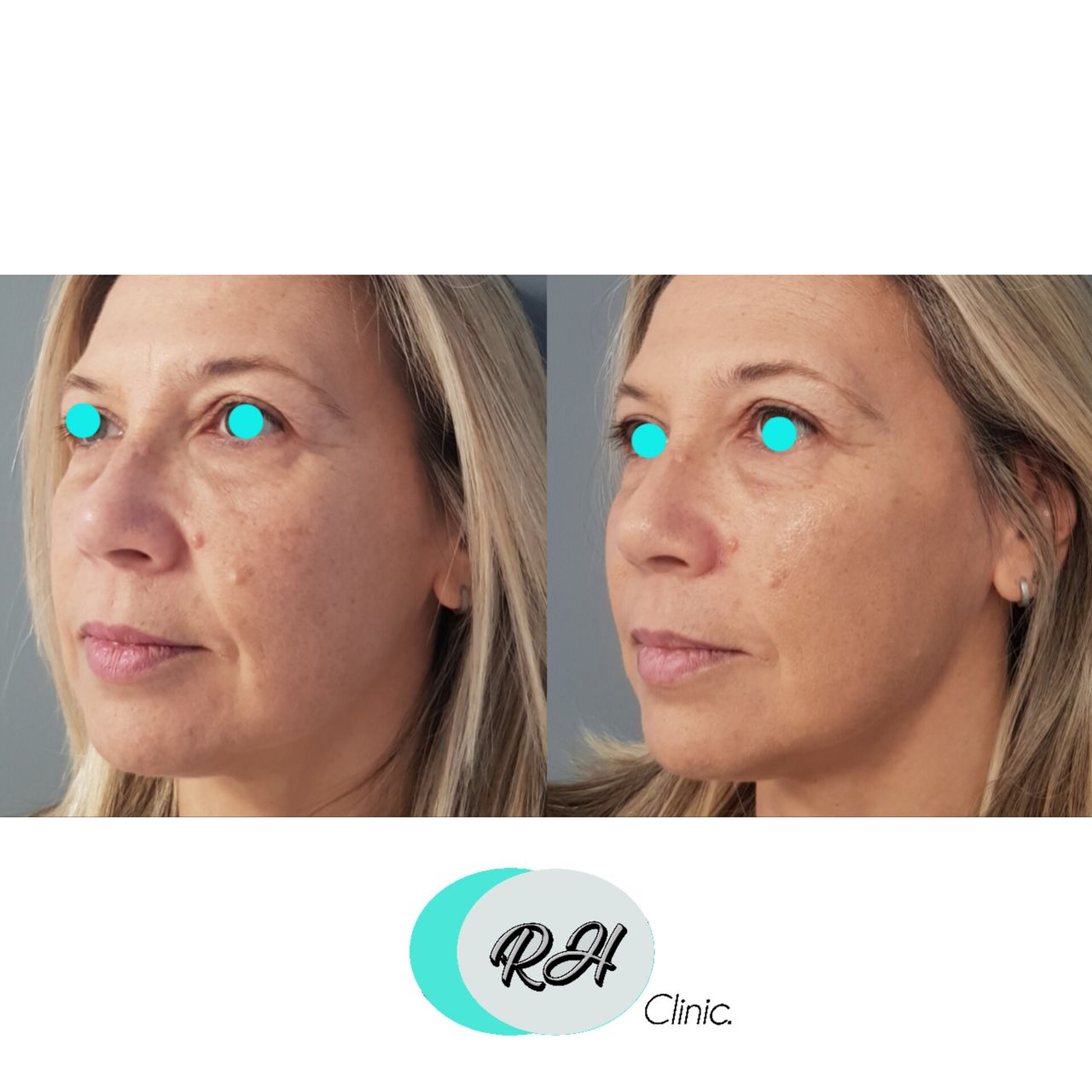 Rosalba Herrero Zerpa-88