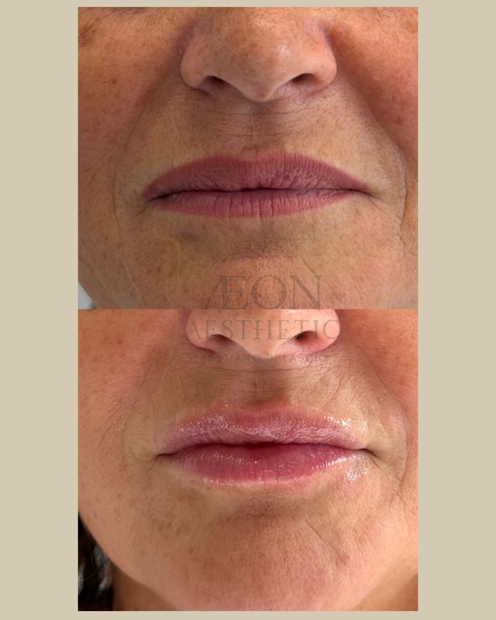 Sebastiano Di Lascio-12