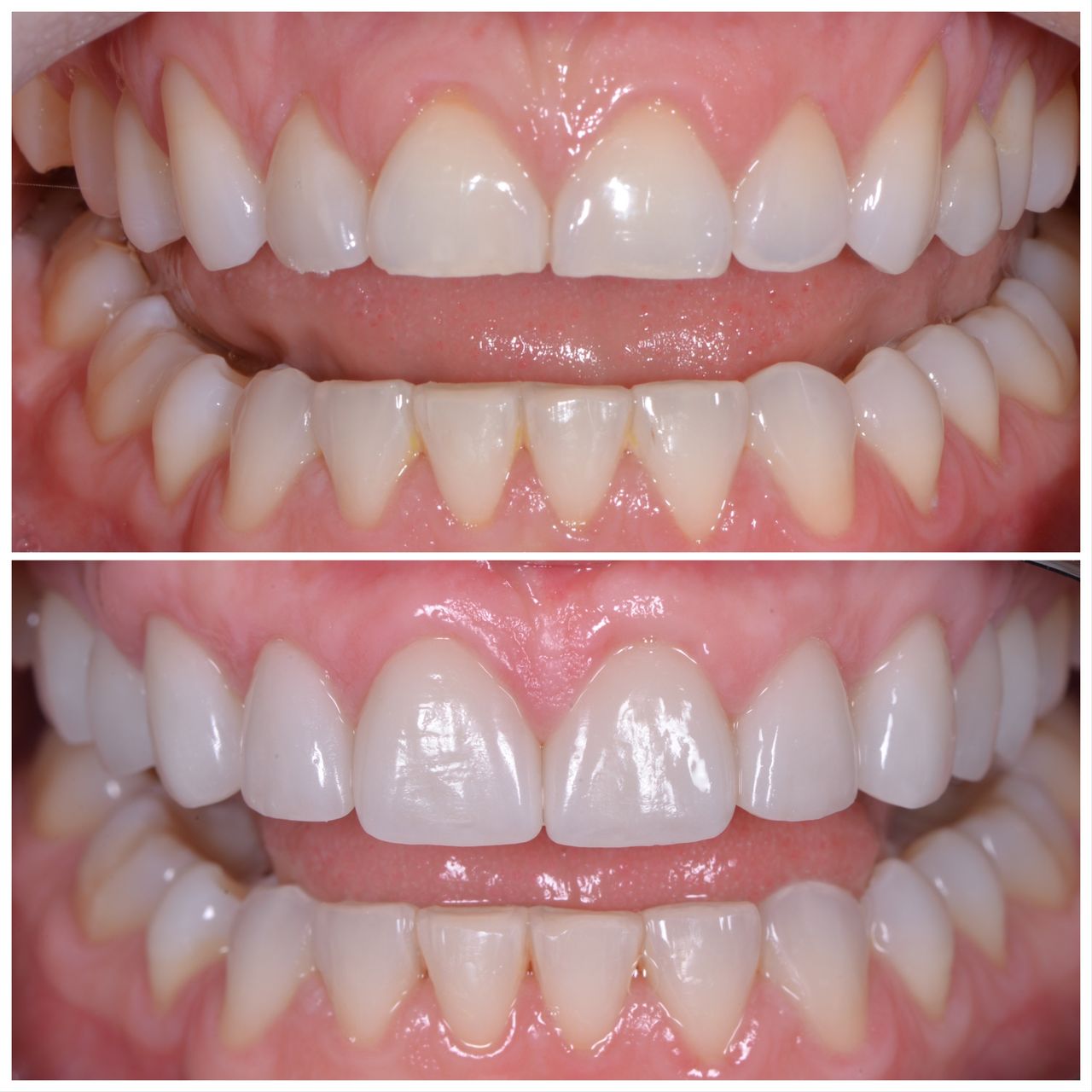 Martin Bartoszcze-24