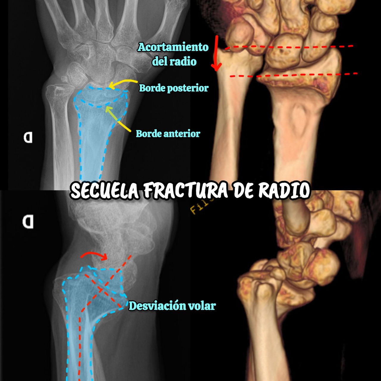 Derlis Sotelo García-14