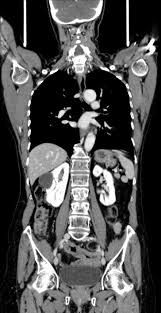 Massimiliano Sperandio-0