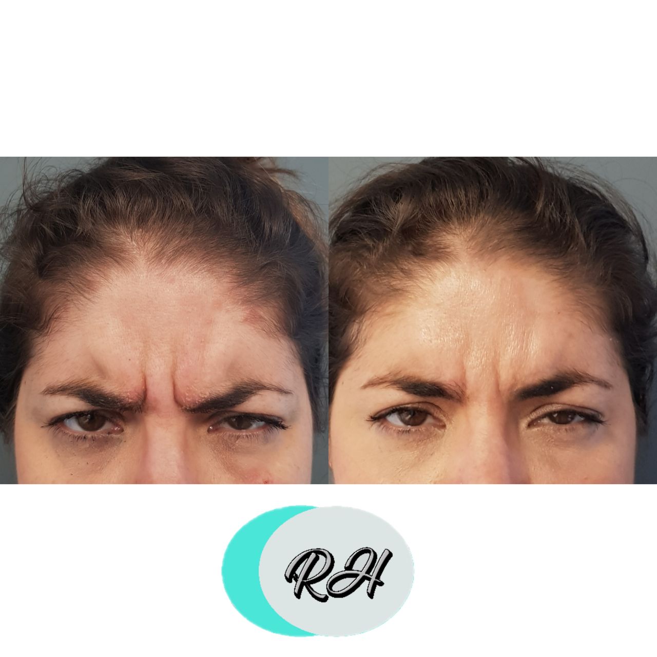 Rosalba Herrero Zerpa-186