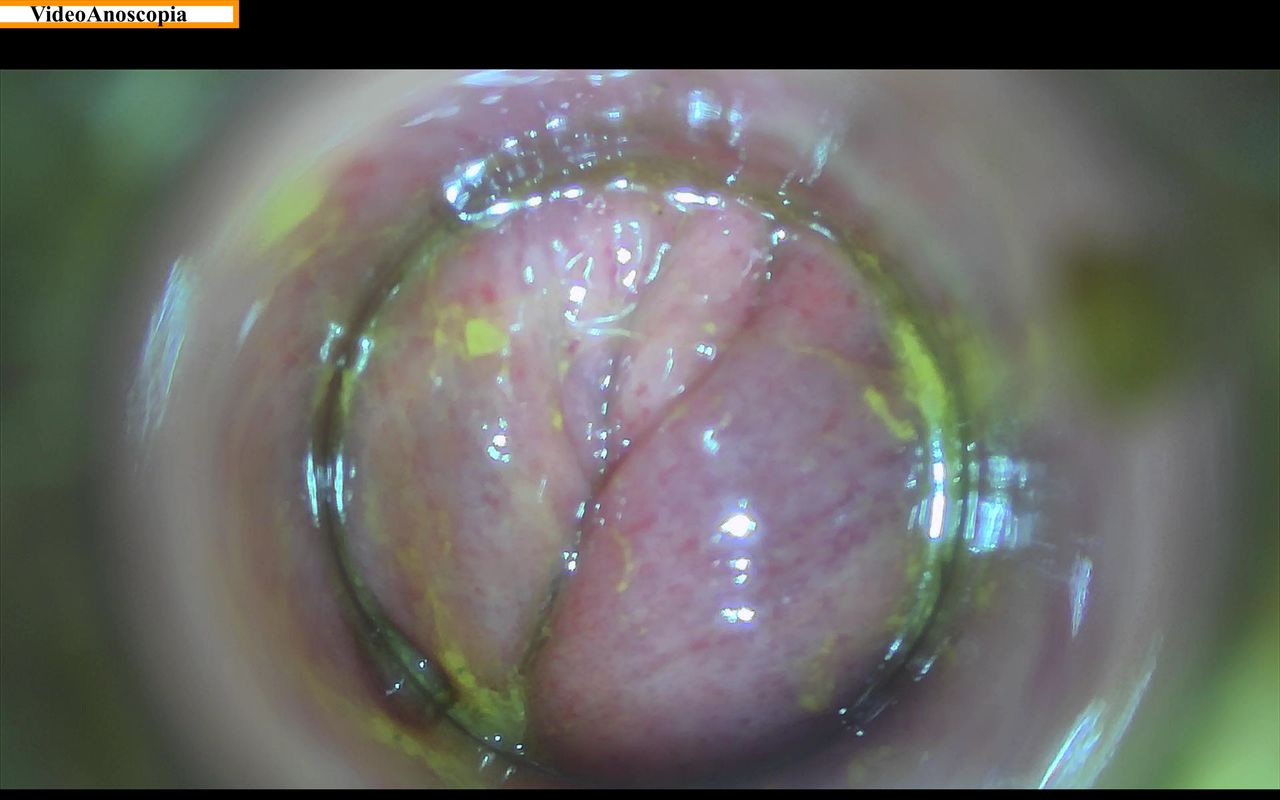 Francesco Maria Romano-20