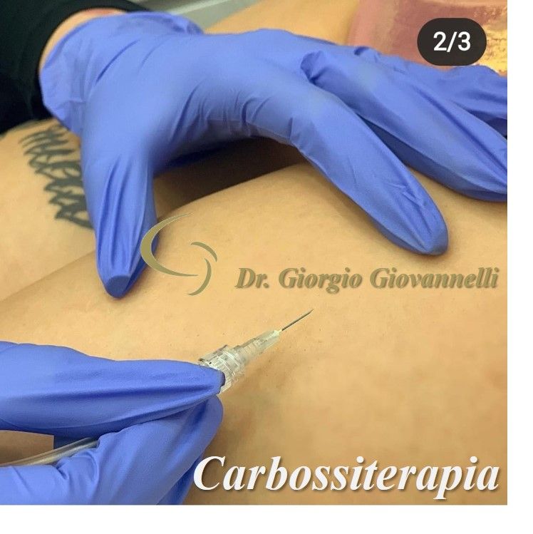 Giorgio Giovannelli-56