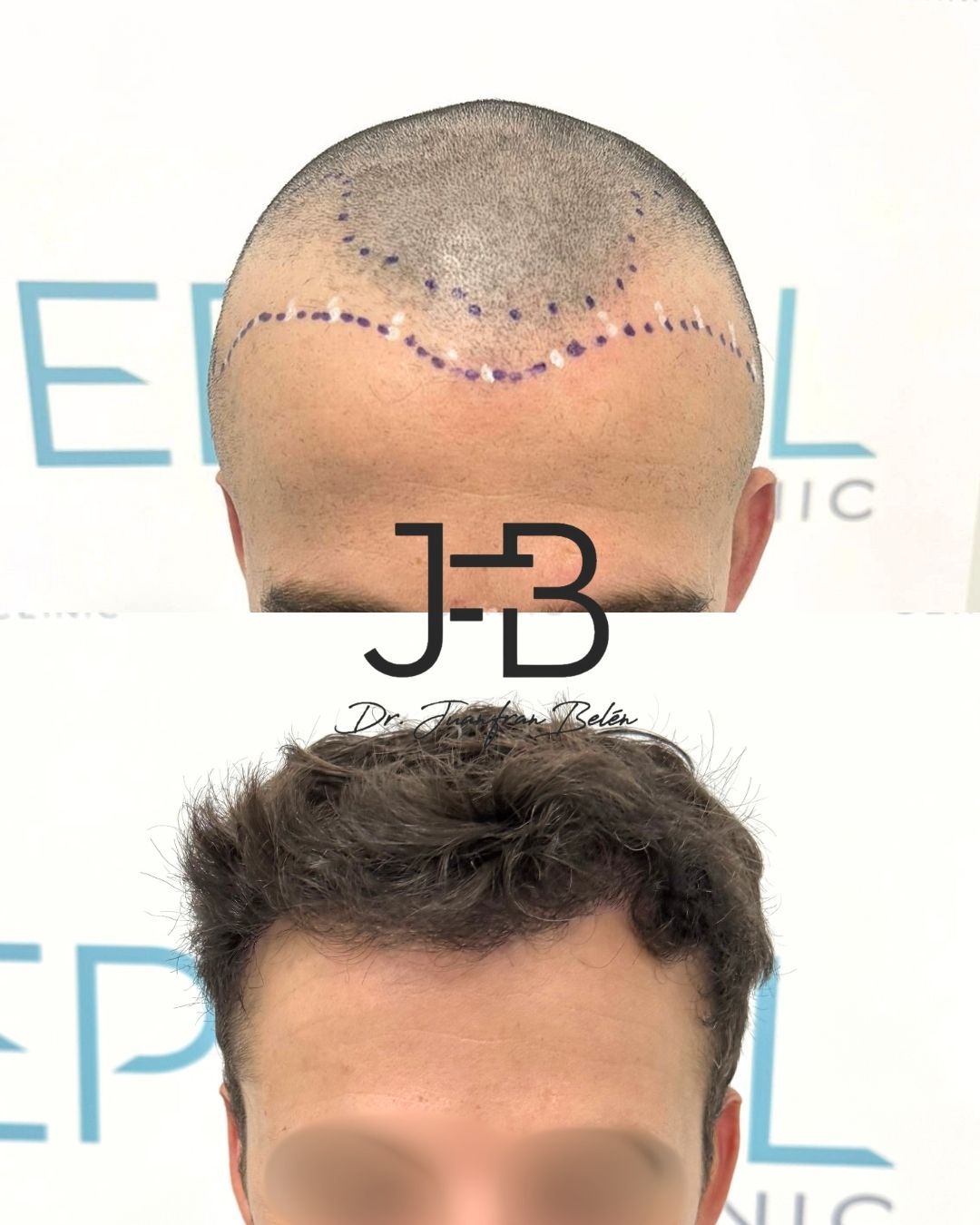 Juan Francisco Belén Montero-2