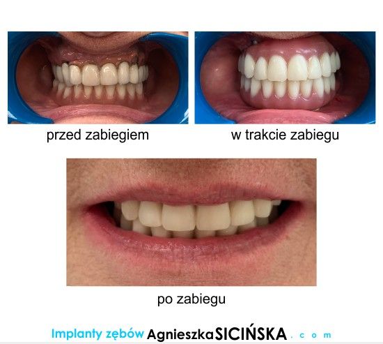 Agnieszka Ewa Sicińska-12